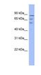 TRNA Methyltransferase 1 Like antibody, NBP1-80371, Novus Biologicals, Western Blot image 