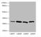 Carbonic Anhydrase 3 antibody, A62194-100, Epigentek, Western Blot image 