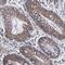 Zinc Finger Protein 550 antibody, NBP1-86158, Novus Biologicals, Immunohistochemistry frozen image 