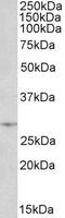 Proopiomelanocortin antibody, EB06727, Everest Biotech, Western Blot image 