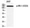 Insulin Receptor Substrate 1 antibody, PA5-40280, Invitrogen Antibodies, Western Blot image 