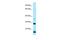 Interferon Alpha 16 antibody, PA5-45146, Invitrogen Antibodies, Western Blot image 