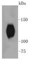 Neurotrophic Receptor Tyrosine Kinase 2 antibody, NBP2-67578, Novus Biologicals, Western Blot image 