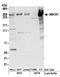 ATP Binding Cassette Subfamily A Member 7 antibody, A304-427A, Bethyl Labs, Western Blot image 