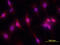 Somatostatin Receptor 2 antibody, MAB4224, R&D Systems, Immunocytochemistry image 