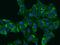 SERPINE1 MRNA Binding Protein 1 antibody, 202919-T02, Sino Biological, Immunohistochemistry paraffin image 