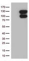 VPS50 Subunit Of EARP/GARPII Complex antibody, TA812020, Origene, Western Blot image 