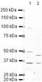 Potassium Voltage-Gated Channel Subfamily A Member 6 antibody, PA5-19498, Invitrogen Antibodies, Western Blot image 