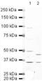 Potassium Voltage-Gated Channel Subfamily A Member 6 antibody, PA5-19498, Invitrogen Antibodies, Western Blot image 