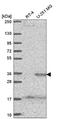 Sprouty RTK Signaling Antagonist 4 antibody, NBP2-56160, Novus Biologicals, Western Blot image 