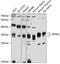 Protein Phosphatase 6 Catalytic Subunit antibody, 19-253, ProSci, Western Blot image 