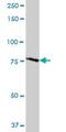 Threonyl-TRNA Synthetase 2, Mitochondrial antibody, H00080222-B01P, Novus Biologicals, Western Blot image 