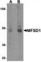 Major Facilitator Superfamily Domain Containing 1 antibody, TA320004, Origene, Western Blot image 