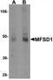 Major Facilitator Superfamily Domain Containing 1 antibody, TA320004, Origene, Western Blot image 