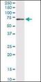 Guanylate Binding Protein 1 antibody, orb89589, Biorbyt, Western Blot image 