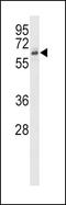 Activin A Receptor Type 2B antibody, PA5-13888, Invitrogen Antibodies, Western Blot image 