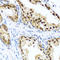 hHR23B antibody, A02174-1, Boster Biological Technology, Immunohistochemistry paraffin image 