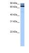 Adenosine Deaminase Domain Containing 2 antibody, NBP1-57403, Novus Biologicals, Western Blot image 