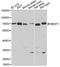 Bestrophin 1 antibody, A3022, ABclonal Technology, Western Blot image 