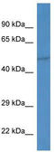 Inositol-Pentakisphosphate 2-Kinase antibody, TA344669, Origene, Western Blot image 