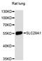 Solute Carrier Family 29 Member 1 (Augustine Blood Group) antibody, A13205, ABclonal Technology, Western Blot image 