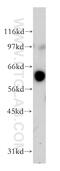 Fucosyltransferase 8 antibody, 12560-1-AP, Proteintech Group, Western Blot image 