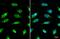 Sirtuin 1 antibody, GTX134606, GeneTex, Immunofluorescence image 