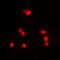 SWI/SNF Related, Matrix Associated, Actin Dependent Regulator Of Chromatin, Subfamily B, Member 1 antibody, abx142233, Abbexa, Western Blot image 