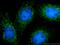 Interferon Induced Protein With Tetratricopeptide Repeats 2 antibody, 12604-1-AP, Proteintech Group, Immunofluorescence image 