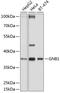 G Protein Subunit Beta 1 antibody, GTX64622, GeneTex, Western Blot image 