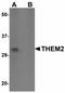 Acyl-CoA Thioesterase 13 antibody, LS-B5012, Lifespan Biosciences, Western Blot image 