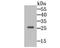 Growth Factor Receptor Bound Protein 2 antibody, NBP2-80405, Novus Biologicals, Western Blot image 