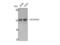 Aldehyde Dehydrogenase 3 Family Member A1 antibody, STJ96390, St John