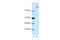 SPT6 Homolog, Histone Chaperone And Transcription Elongation Factor antibody, 28-831, ProSci, Western Blot image 