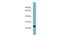 RAB22A, Member RAS Oncogene Family antibody, A05967, Boster Biological Technology, Western Blot image 