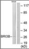 BRI3 Binding Protein antibody, orb96524, Biorbyt, Western Blot image 
