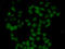 Fibroblast Growth Factor 14 antibody, STJ28671, St John