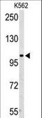 Adenosine Monophosphate Deaminase 2 antibody, LS-C156316, Lifespan Biosciences, Western Blot image 