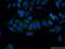 Visinin Like 1 antibody, 13919-1-AP, Proteintech Group, Immunofluorescence image 