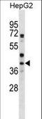 Wnt Family Member 6 antibody, LS-C160636, Lifespan Biosciences, Western Blot image 