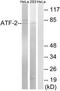 Activating Transcription Factor 2 antibody, TA326068, Origene, Western Blot image 