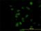 CDK5 Regulatory Subunit Associated Protein 3 antibody, H00080279-M01, Novus Biologicals, Immunofluorescence image 