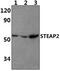 STEAP2 Metalloreductase antibody, PA5-75929, Invitrogen Antibodies, Western Blot image 
