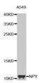 Neuropeptide Y antibody, LS-C332403, Lifespan Biosciences, Western Blot image 