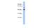 Olfactomedin Like 1 antibody, A15585, Boster Biological Technology, Western Blot image 