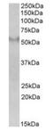 Fibronectin Type III And SPRY Domain Containing 1 antibody, orb19156, Biorbyt, Western Blot image 