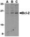 Arylsulfatase B antibody, orb19689, Biorbyt, Western Blot image 