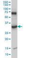 DNA-3-methyladenine glycosylase antibody, LS-C133327, Lifespan Biosciences, Western Blot image 