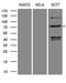 Decapping MRNA 1B antibody, LS-C795198, Lifespan Biosciences, Western Blot image 