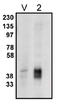 Phospholipid Phosphatase 2 antibody, AP05145PU-N, Origene, Western Blot image 